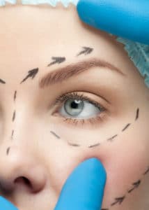 eyelid surgery