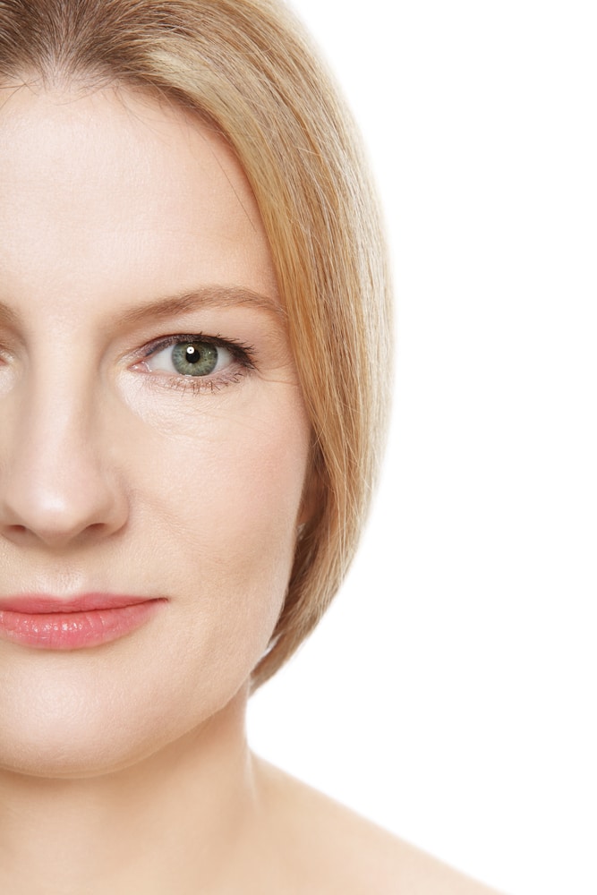 Blepharoplasty Houston, TX