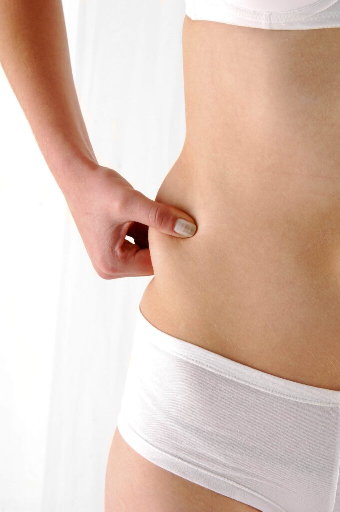 Liposuction Houston, TX