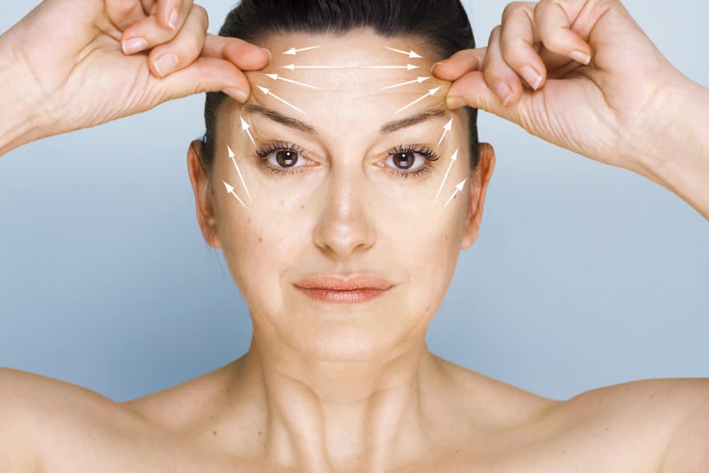 Portrait of 50 year old woman looking at camera, lifting her forehead wrinkles with guidelines showing lifting direction to show a what a forehead lift will target