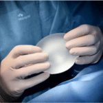 Breast augmentation