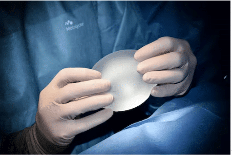 Breast augmentation