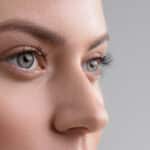 Rhinoplasty