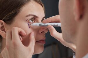 Woman having her lower eyelid marked by her surgeon before her blepharoplasty